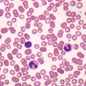 혈구 (슬라이드 표본)